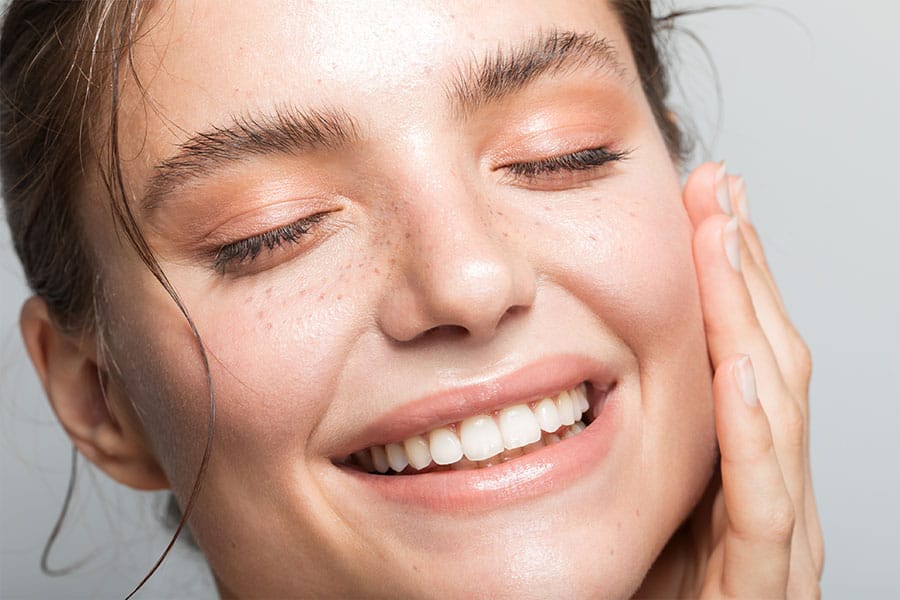 Rosacea and Laser Treatments